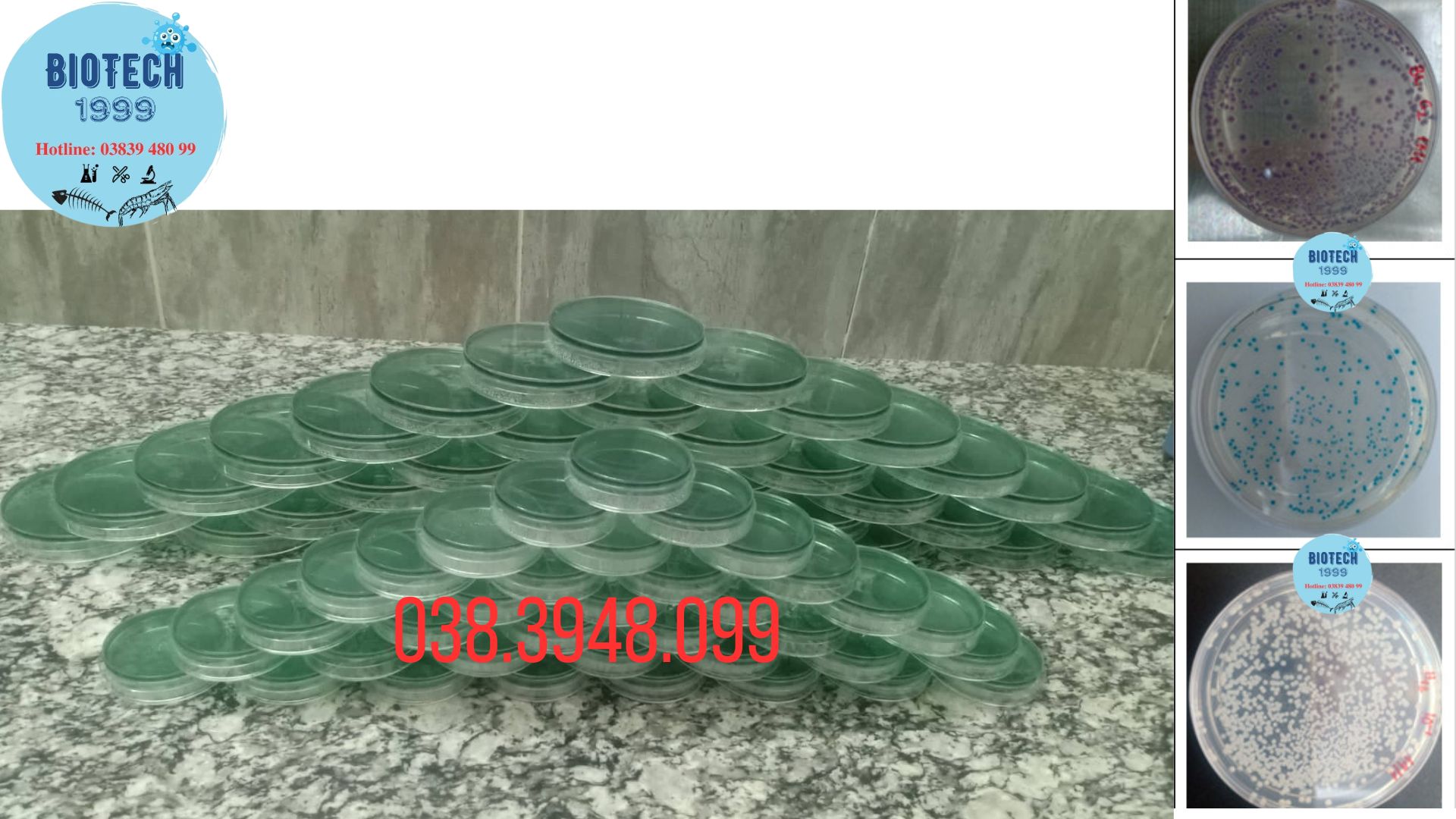 Đĩa kiểm khuẩn Vibrio paraheamolyticus , vulnificus, chlolerrae,.. tom