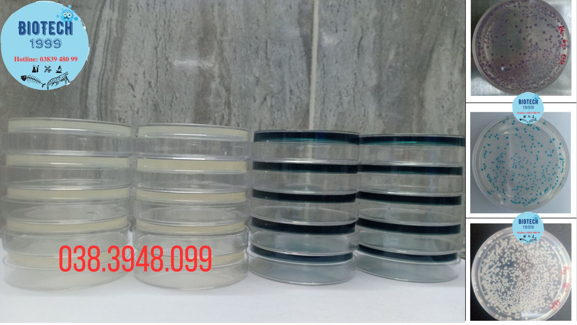 Đĩa kiểm khuẩn Vibrio paraheamolyticus , vulnificus, chlolerrae,.. tom