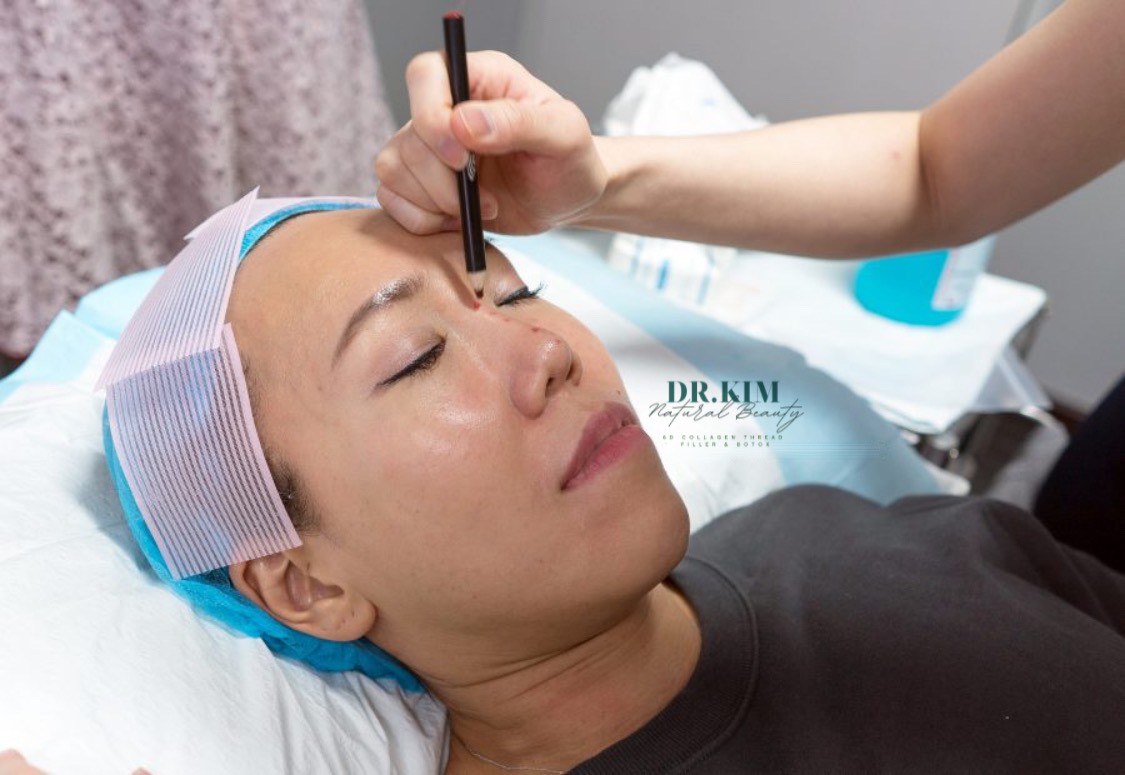 N&AcircNG MŨI CẤU TR&UacuteC CHỈ COLLAGEN - DR.KIM 