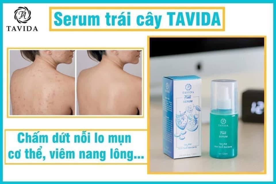 Xịt Mụn Lưng Viêm Nang Lông Men vi sinh Tavida bản mới dung tích 125ml