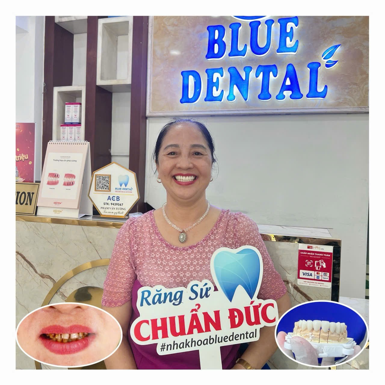 Địa chỉ làm răng uy tín tại quận Tân Bình, nha khoa Blue Dental