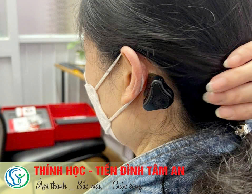 Máy trợ thính đường xương Adhear - máy trợ thính chính hãng
