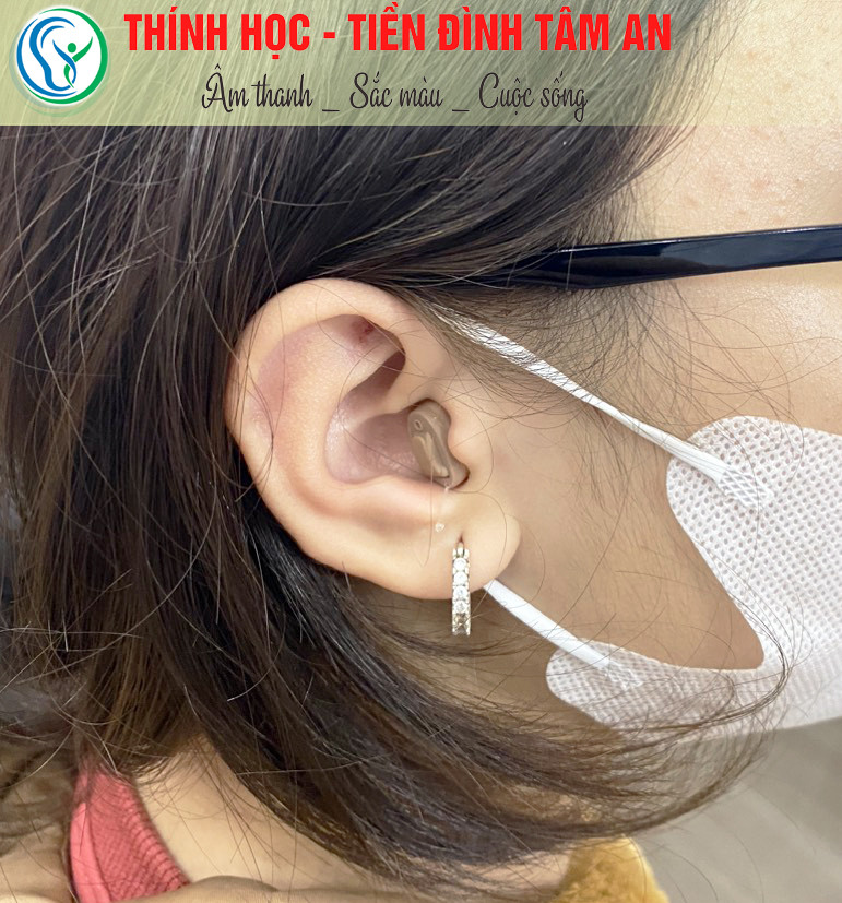 Máy trợ thính trong tai Insio CIC IX tại Hải Phòng