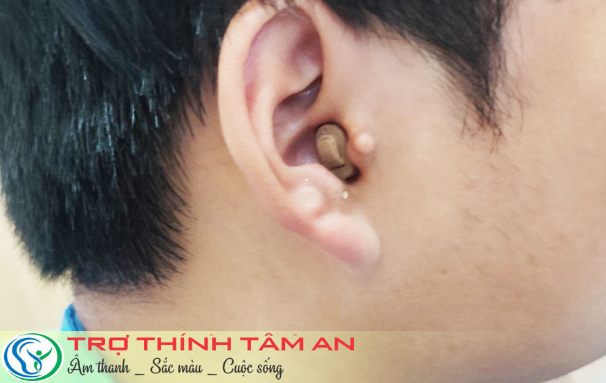 Máy trợ thính thẩm mỹ - máy trợ thính trong tai