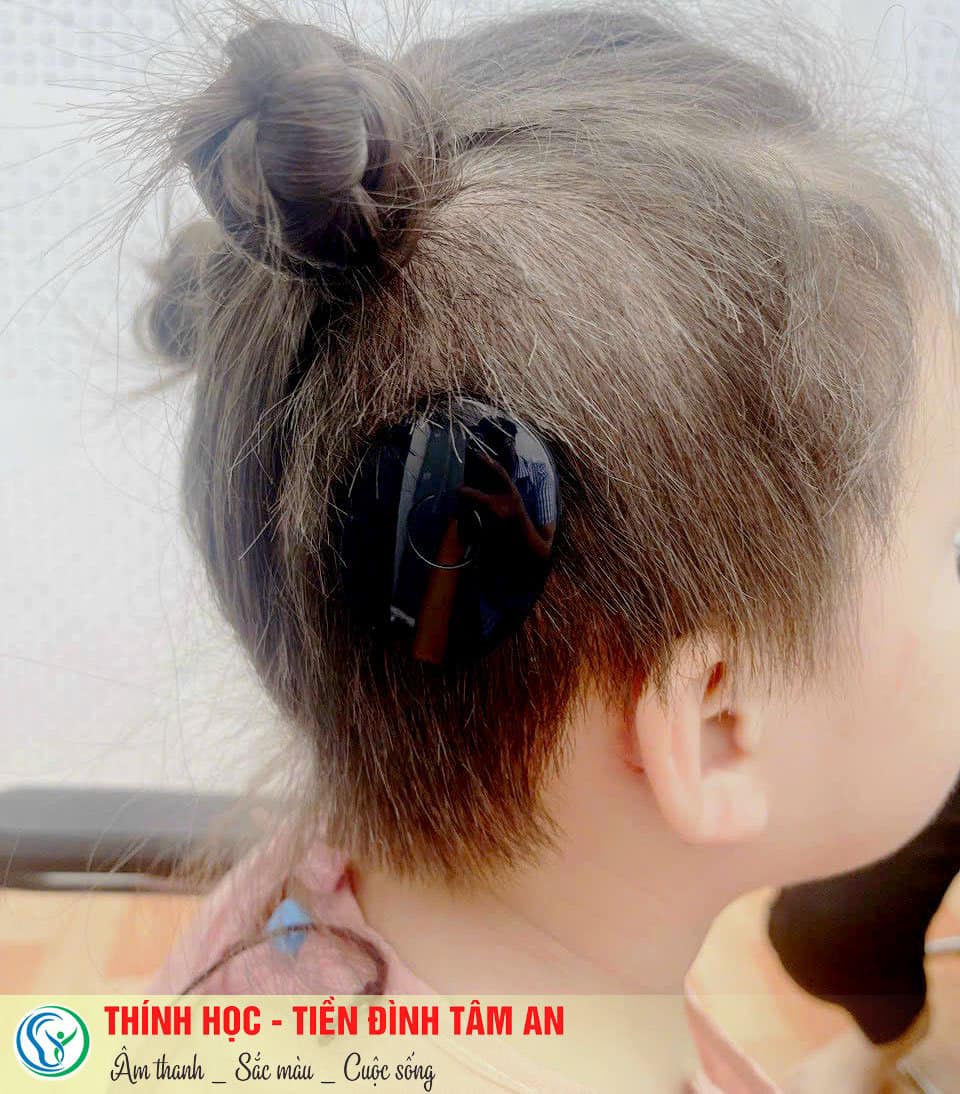 Các phương thức can thiệp dành cho trẻ nghe kém