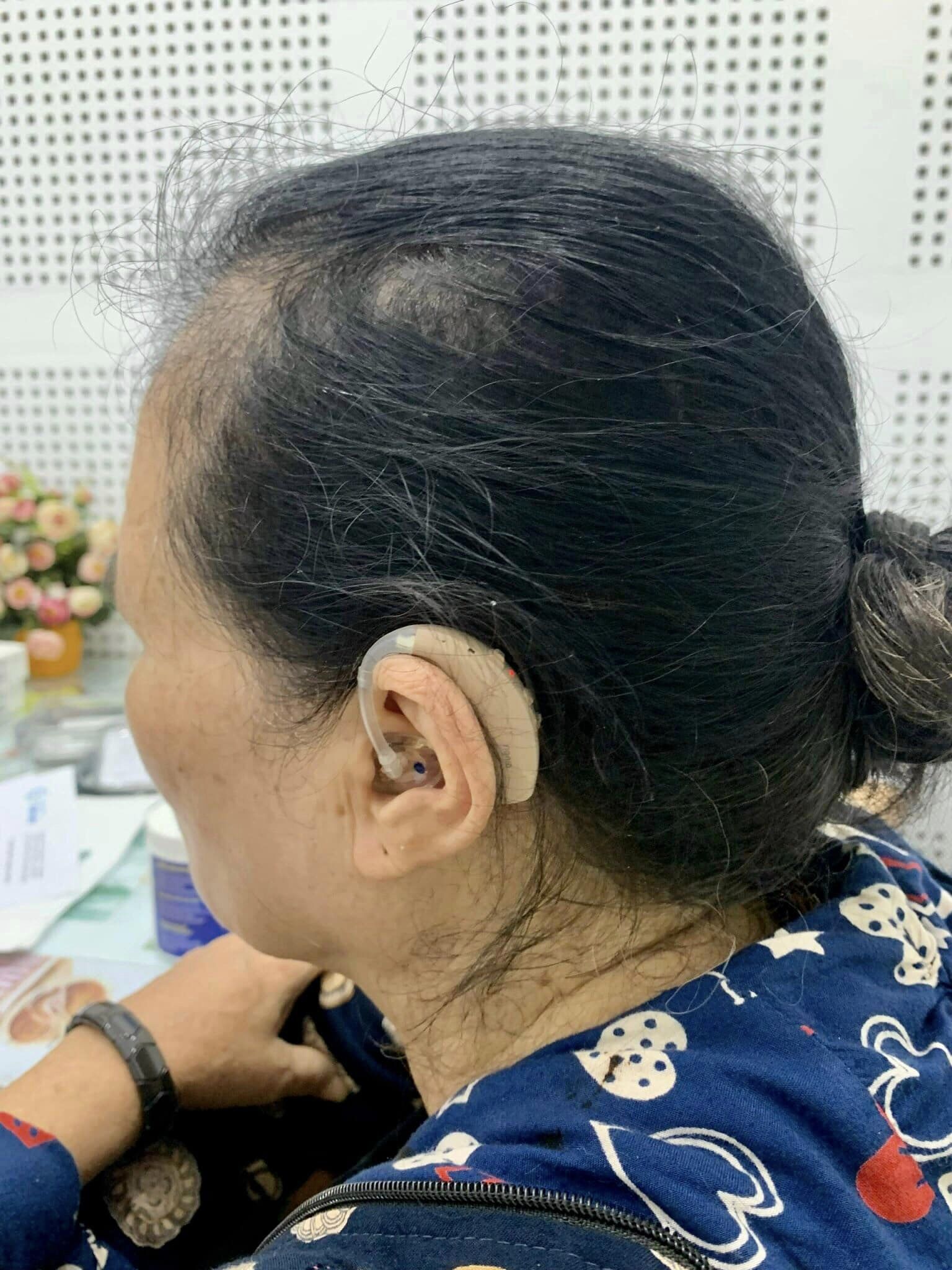 Đeo máy trợ thính hai tai để đạt hiệu quả tốt nhất