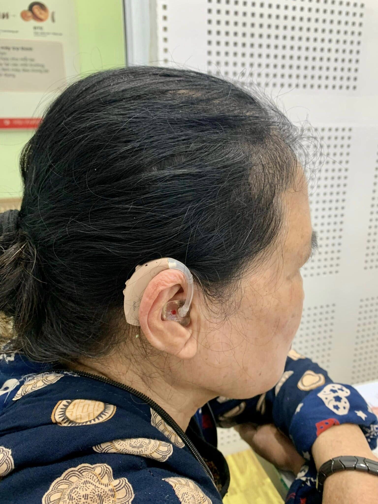 Đeo máy trợ thính hai tai để đạt hiệu quả tốt nhất