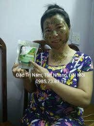 Thảo dược Đặc Trị Nám
