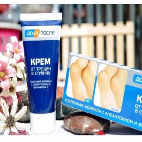 Kem Trị Nứt Gót Chân Kpem Apteka Của Nga