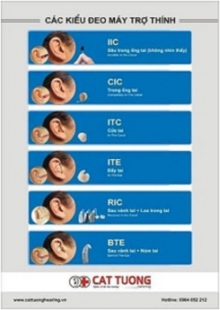 DỊCH VỤ TẠI NHÀ: ĐO THỬ MÁY VÀ HIỆU CHỈNH MÁY TRỢ THÍNH