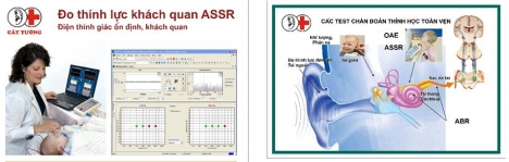 Dịch vụ trợ thính tại Thanh Hóa
