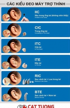 dịch vụ thử máy trợ thính tại nhà