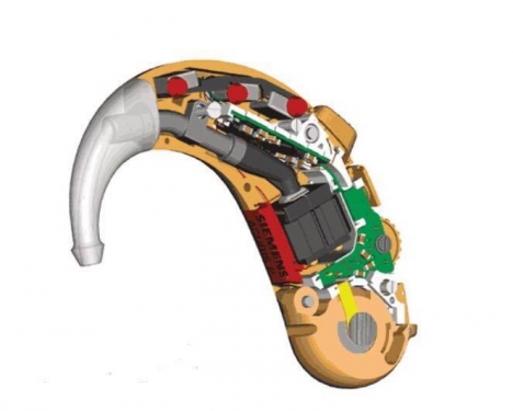 DỊCH VỤ SỬA CHỮA MÁY TRỢ THÍNH