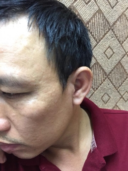 máy trợ thính trong tai tốt nhất quảng ninh