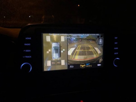 Trải nghiệm Camera 360 TOYOTA CAMRY 2017 – Camera 360 Oview Pro