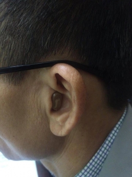 Máy trợ thính trong tai siêu thẩm mỹ