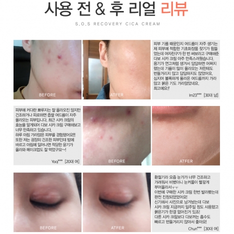 Kem cao cấp phục hồi tái tạo da - DABO S.O.S Recovery CICA Cream