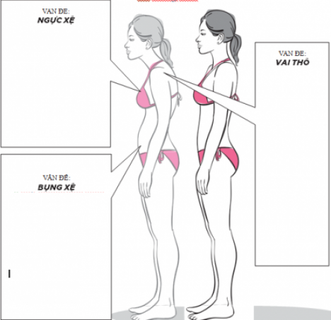 Phẫu thuật nâng ngực chảy xệ