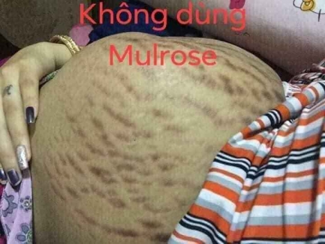 mulrose dược mỹ phẩm thiên nhiên