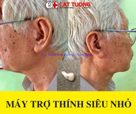 Máy trợ thính siêu nhỏ