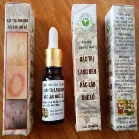 Trị hắc lào, lang ben vẩy nến các loại giá rẻ