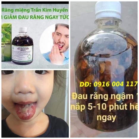 Trị sâu răng, hôi miệng, viêm chân răng giá rẻ