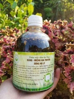 Trị sâu răng, hôi miệng, viêm chân răng giá rẻ