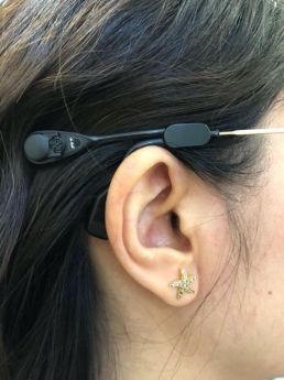 Máy trợ thính gọng kính đường xương