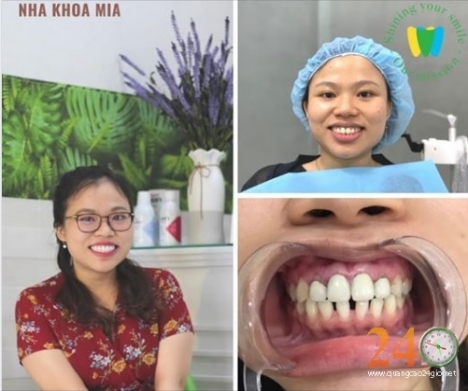 Niềng Răng, Trồng Răng, Chữa Răng Không Đau Giá Rẻ Uy Tín Tại Quận 11