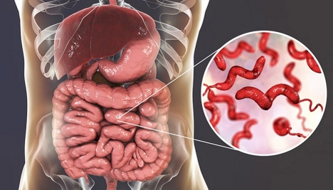 Chảy máu dạ dày là bệnh gì? Bị xuất huyết dạ dày ăn gì? Kiêng gì?