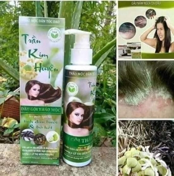 Trị bệnh viêm da đầu, nấm da đầu Lhe 0916004117