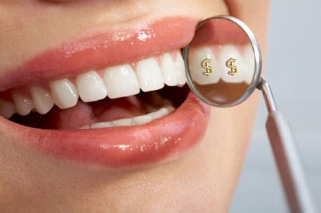 Bọc răng sứ là gì?