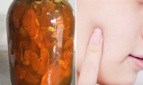 Answer questions about acne scar treatment with fresh turmeric