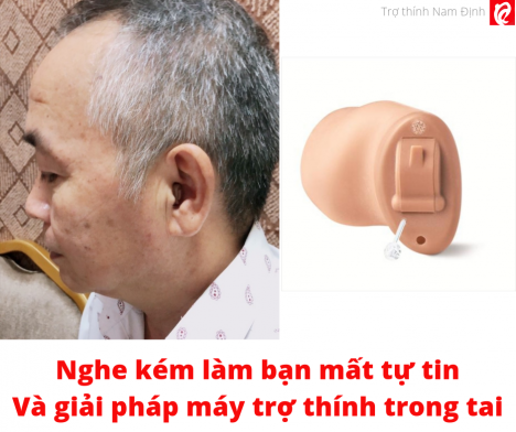 Máy trợ thính trong tai nhỏ gọn thẩm mỹ