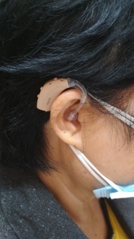 Lợi ích của việc đeo máy trợ thính
