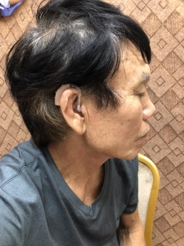 Lựa chọn máy trợ thính theo mức độ nghe