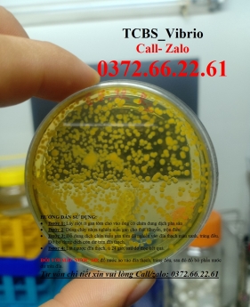 Khuẩn vibrio trên môi trường nuôi cấy TCBS