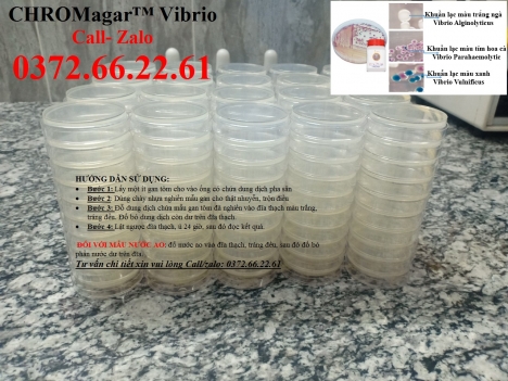 Cách kiểm tra khuẩn vibrio cholerae