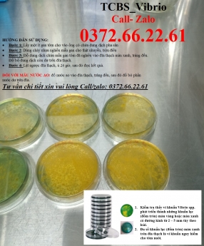 Cách kiểm tra sự hiện diện của vibrio trong môi trường nước nuôi tôm cá - TCBS Agar