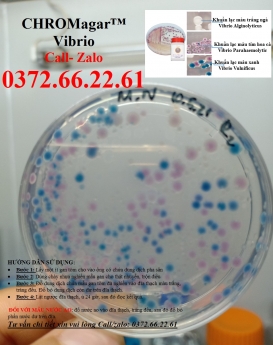 Cách kiểm tra khuẩn vibrio cholerae