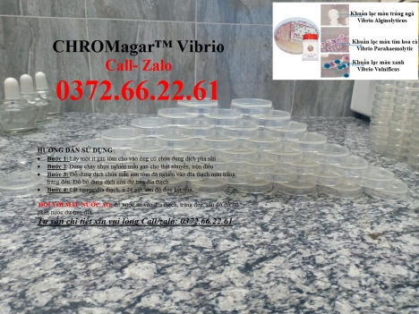 Cách kiểm tra khuẩn vibrio cholerae