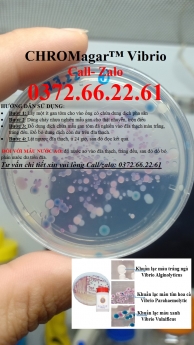 Cách kiểm khuẩn gây bệnh trên tôm - Vibrio