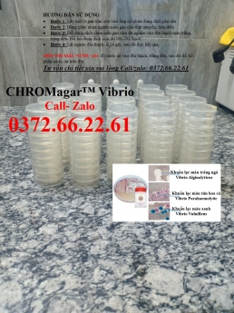 Cách kiểm tra khuẩn vibrio cholerae