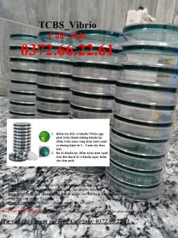 Cách kiểm tra nhanh khuẩn gây hại trong ao tôm - TCBS Agar