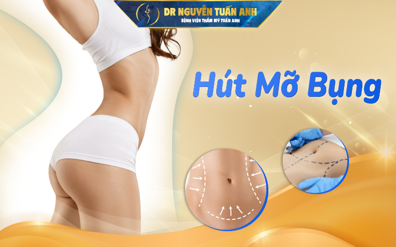 Giải pháp hút mỡ làm đẹp an toàn hiệu quả cao