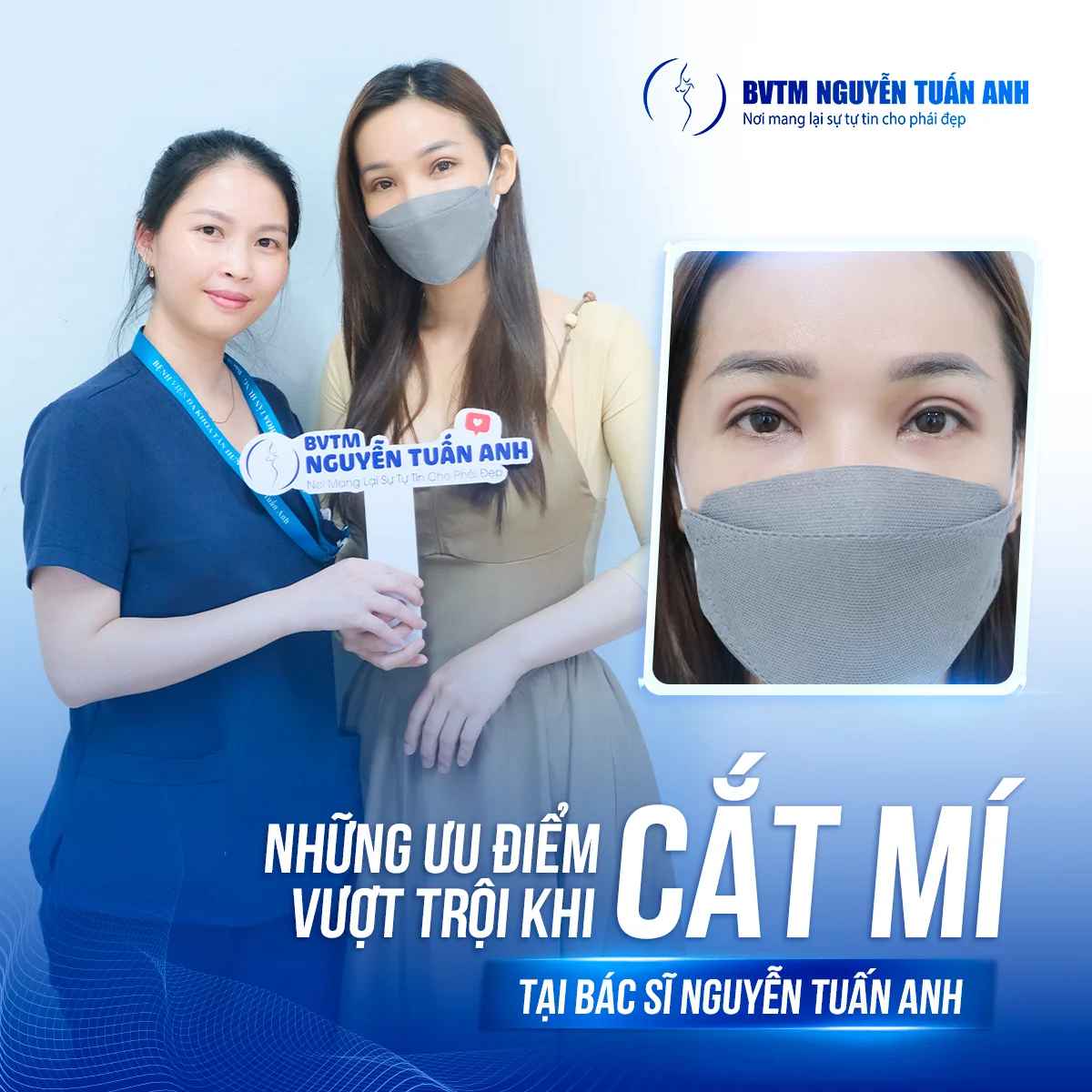 Bác sĩ thẩm mỹ Nguyễn Tuấn Anh - Những ưu điểm vượt trội khi cắt mí