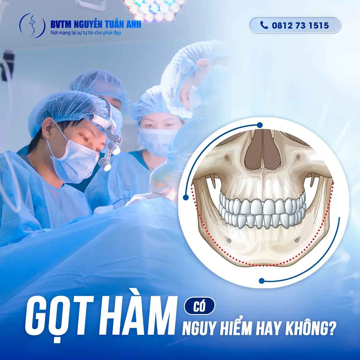 BS Thẩm Mỹ Nguyễn Tuấn Anh-Gọt Hàm V Line Có Nguy Hiểm Hay Không?