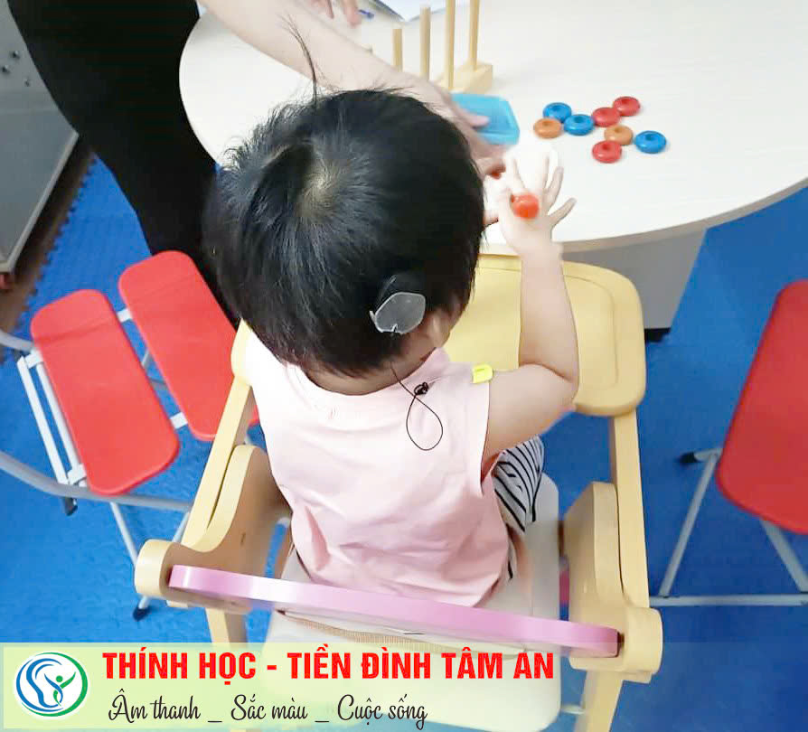 Đo thính lực cho trẻ em, điếc bẩm sinh, điện cực ốc tai, máy trợ thính