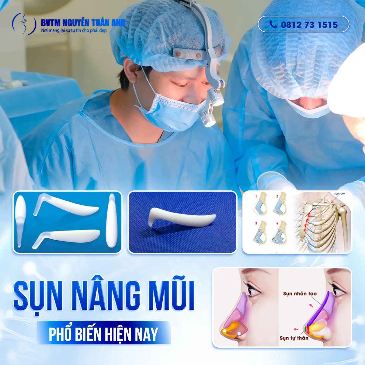 Những Loại Sụn Nâng Mũi Phổ Biến Hiện Nay