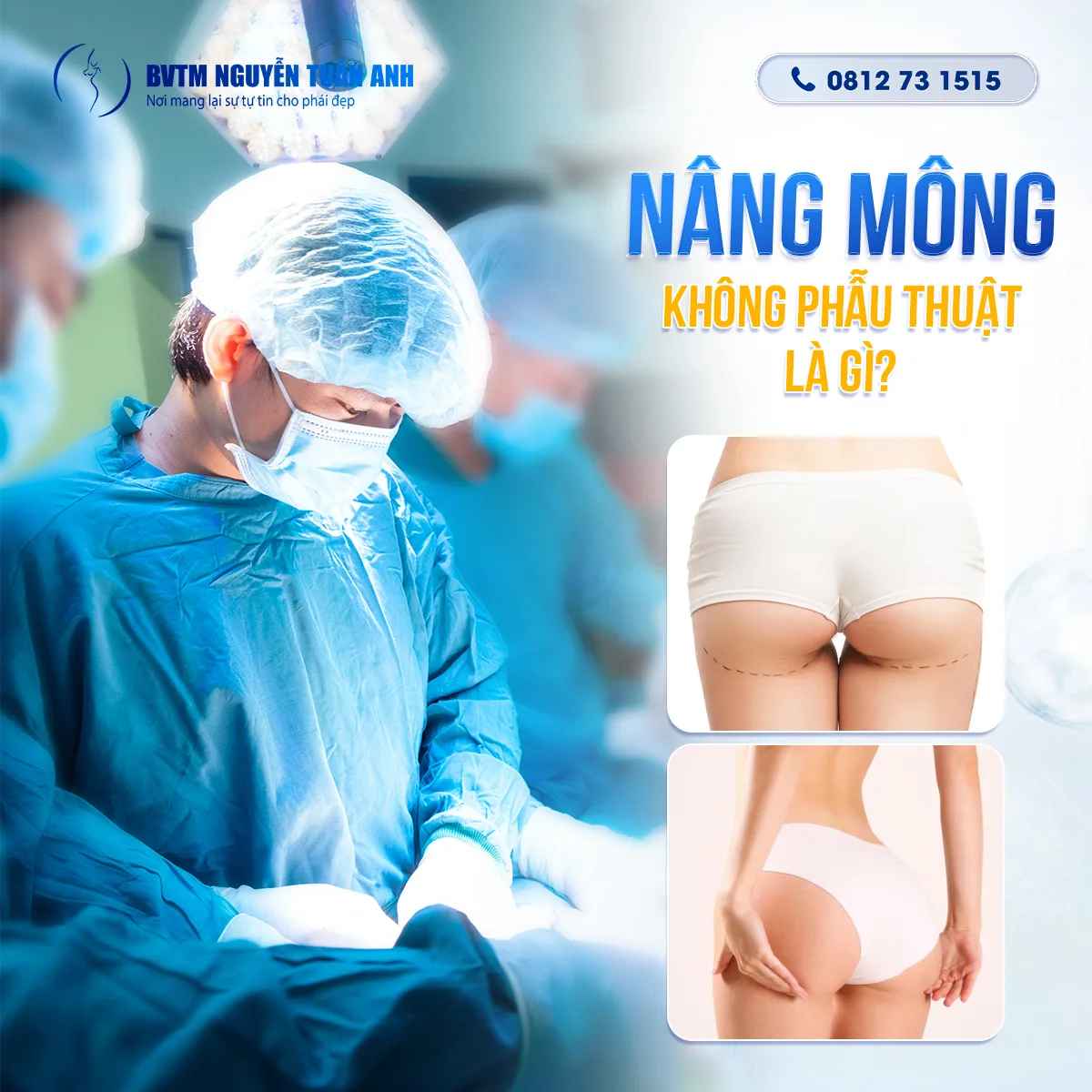 Nâng Mông Không Phẫu Thuật Là Như Thế Nào?